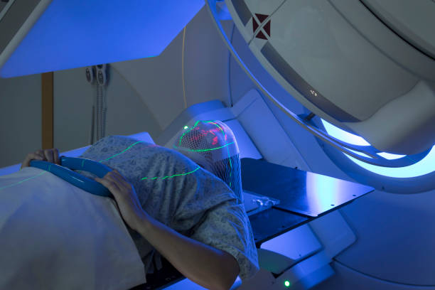 radiation treatment