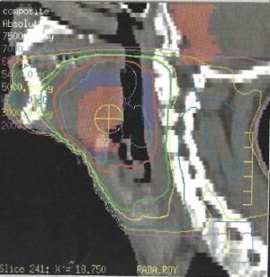 Radiation Map